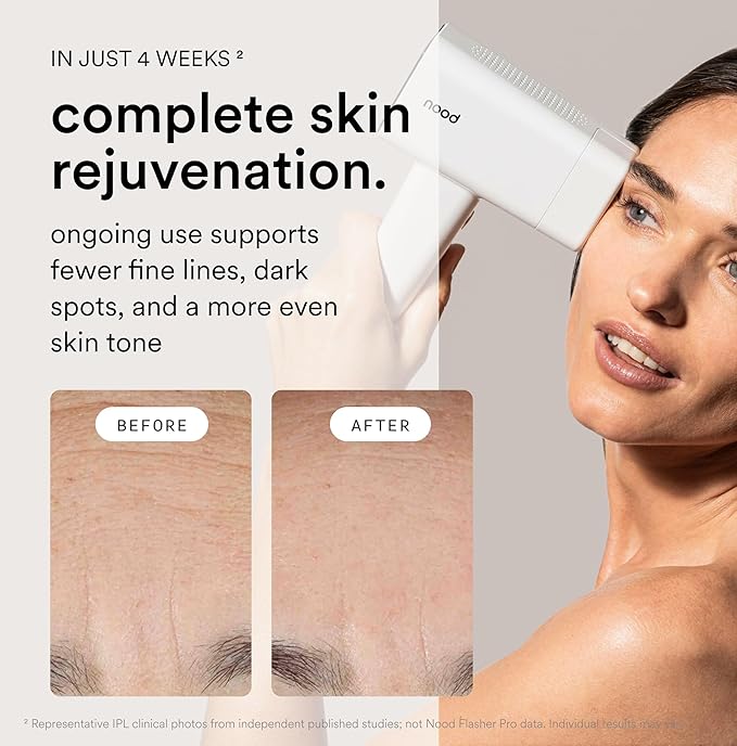 Nood™ NEW Flasher Pro — IPL Laser Hair Removal Device & Anti-Aging Red Light