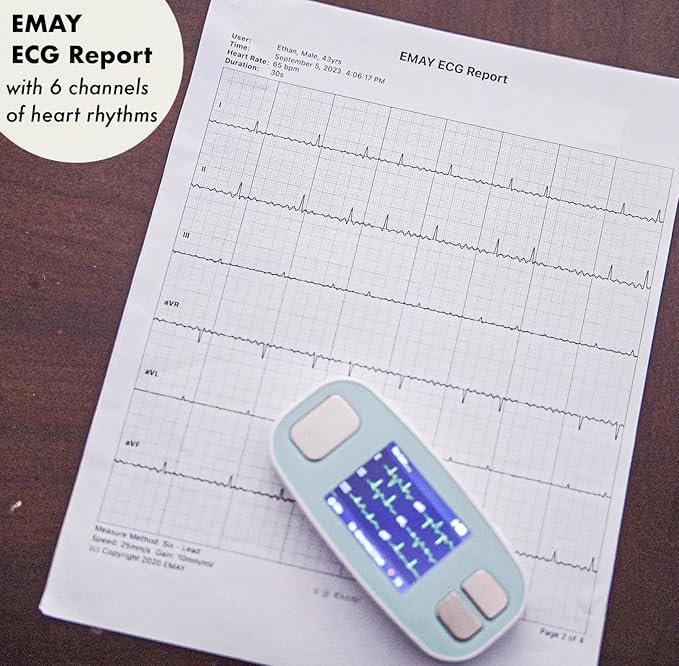 EMAY 6L Portable ECG Monitor | Record ECG and Heart Rate in 6 Channels |