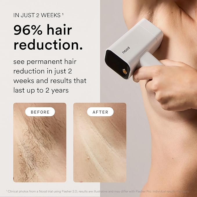 Nood™ NEW Flasher Pro — IPL Laser Hair Removal Device & Anti-Aging Red Light